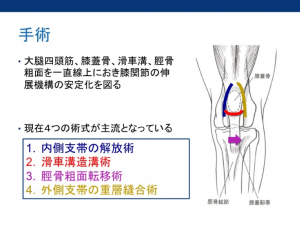 17 6 25 過去ブログ 膝蓋骨内方脱臼を整復した犬の1例